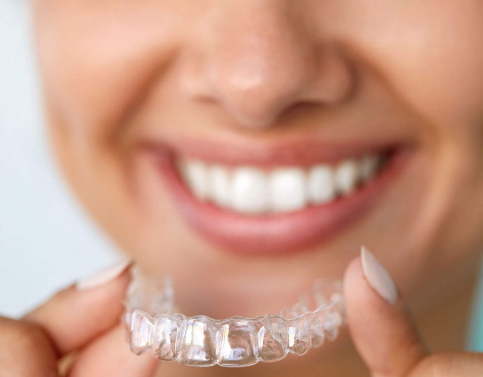 Invisalign in Folsom