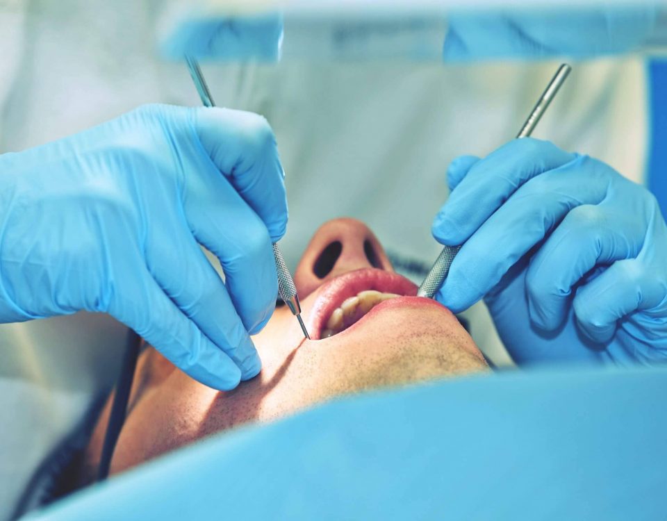 Custom Dental Veneers